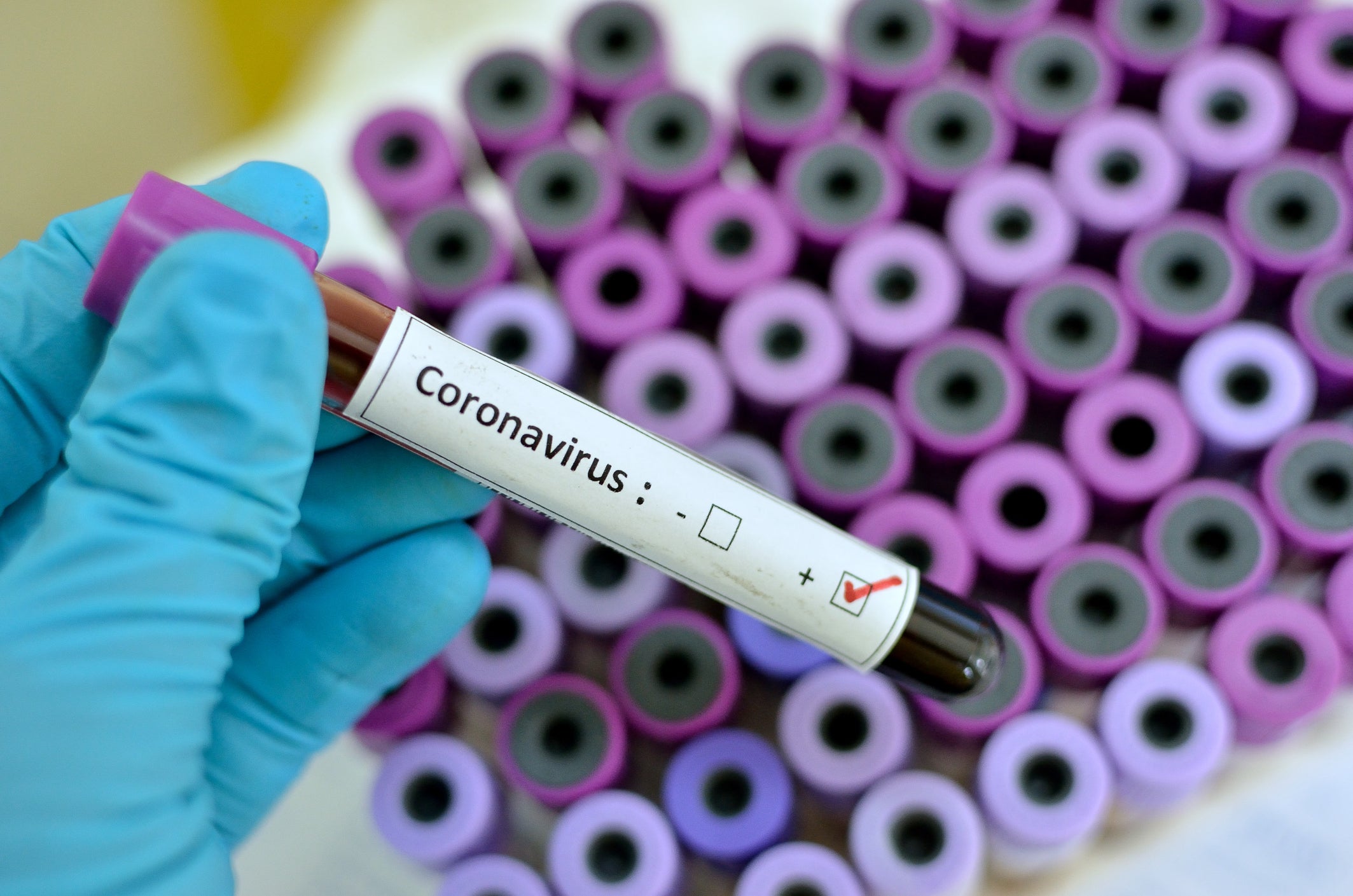 minister tests positive for coronavirus