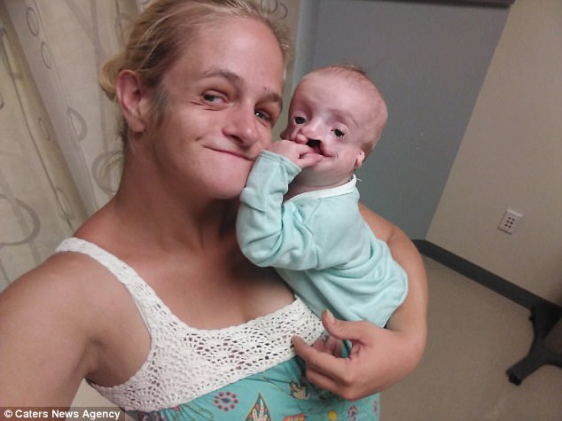 unbelievable-see-the-8-month-old-baby-who-needs-surgery-every-six