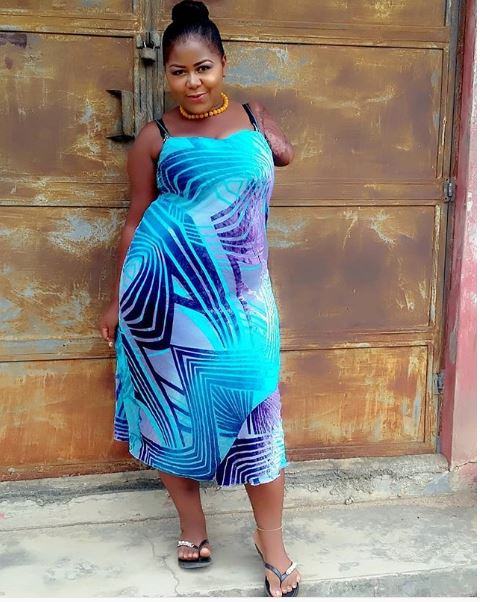 Heartbreaking Photos Of Beautiful Nigerian Lady With Amputated Arm ...