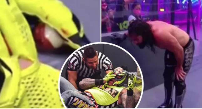 Rey Mysterio's eyes pops out during fight