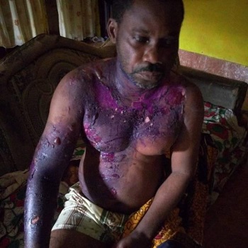 Oyinkro Miebode was bathed with hot water by his wife