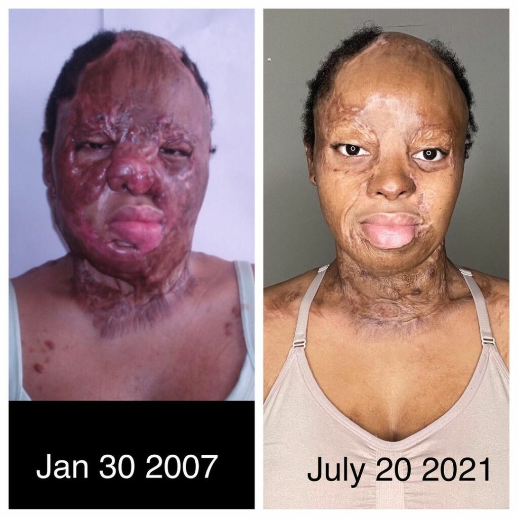 Okwuchi shares before and after photos