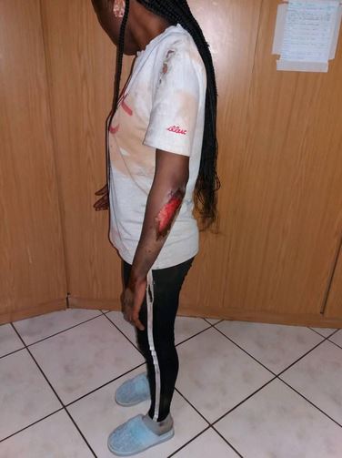 Lady Severely Injured As She Jumps Out Of Moving Car In South Africa To Avoid  R*pe (Photos)