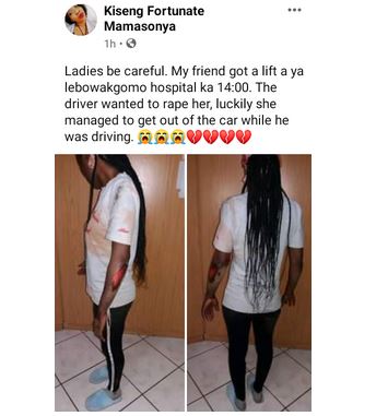 Lady Severely Injured As She Jumps Out Of Moving Car In South Africa To Avoid  R*pe (Photos)