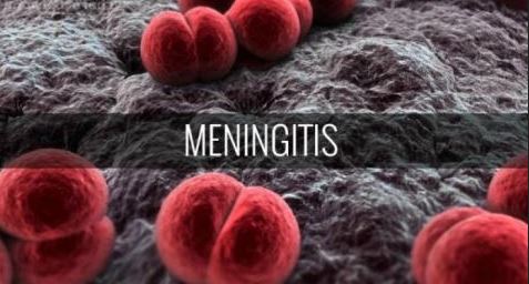 Meningitis