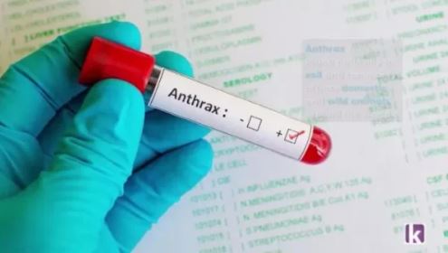 Anthrax vaccines 