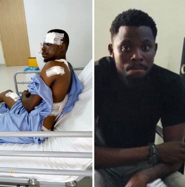 9 Bullets, 3 Surgeries - Nigerian Man Marks Seven Years Since He ...