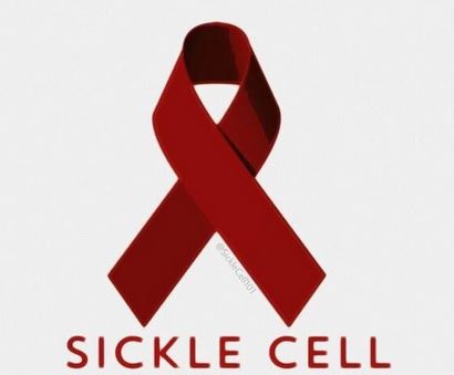 Sickle cell