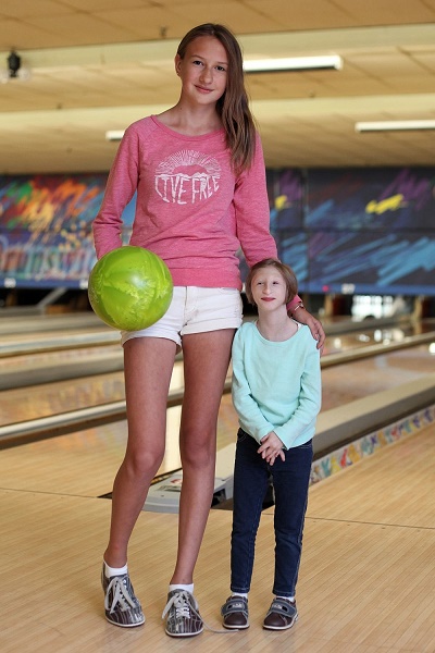 Unbelievable Meet 12 year old Girl Who Weighs Same As A Toddler Photos 