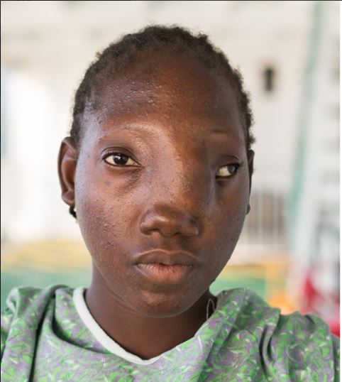 young-girl-with-deformed-face-gets-new-life-after-undergoing-surgery-to