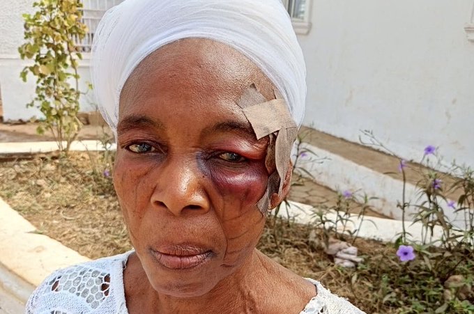 Six ‘Isese’ Worshippers Stoned, Injured In Horrific Attack At Osun Obatala Festival